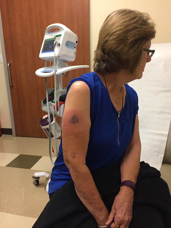 vaccine injury