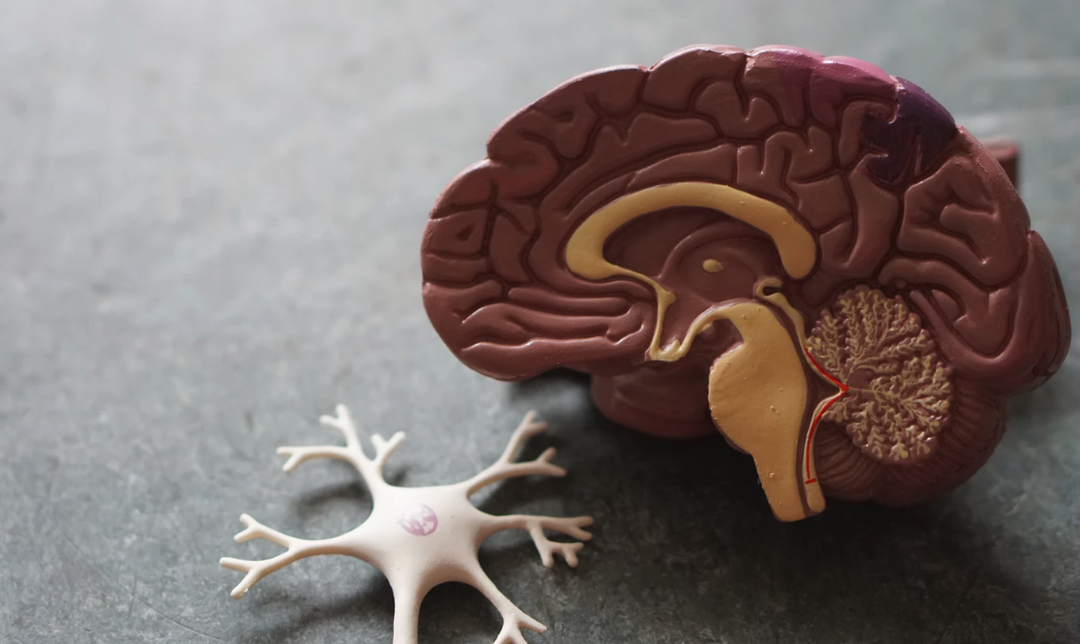 Documented Vaccine Induced Encephalopathy