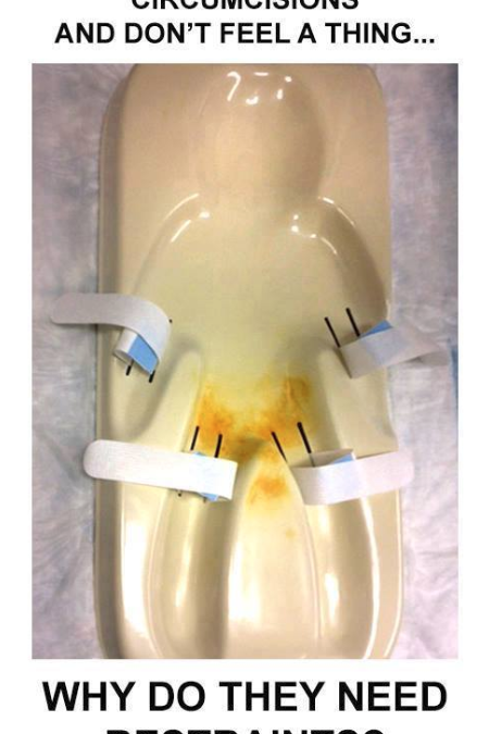 Circumcision – Proven to Cause Permanent Brain Damage