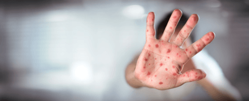 Inventing a Disease That Doesn’t Exist…