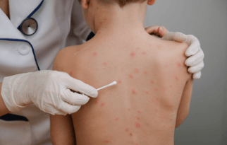 Vaccine Failure Again…………