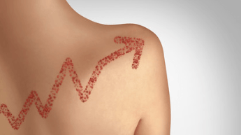 13 People in Australia Come down with Measles……ALL VACCINATED